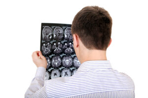 3 FAQs About Filing a Brain Injury Claim
