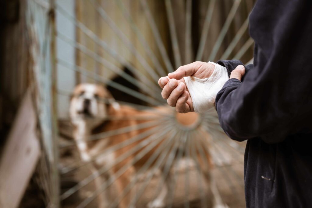 Person with a bandaged hand after a dog bite injury, standing near a fenced dog, representing dog attack and personal injury claim.