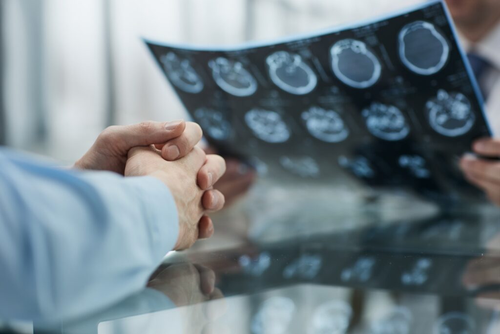 Patient consulting doctor while reviewing brain MRI scans, medical diagnosis and healthcare consultation concept Patient consulting doctor while reviewing brain MRI scans, medical diagnosis and healthcare consultation concept